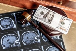 5 Reasons Why You Need a Brain Injury Lawyer